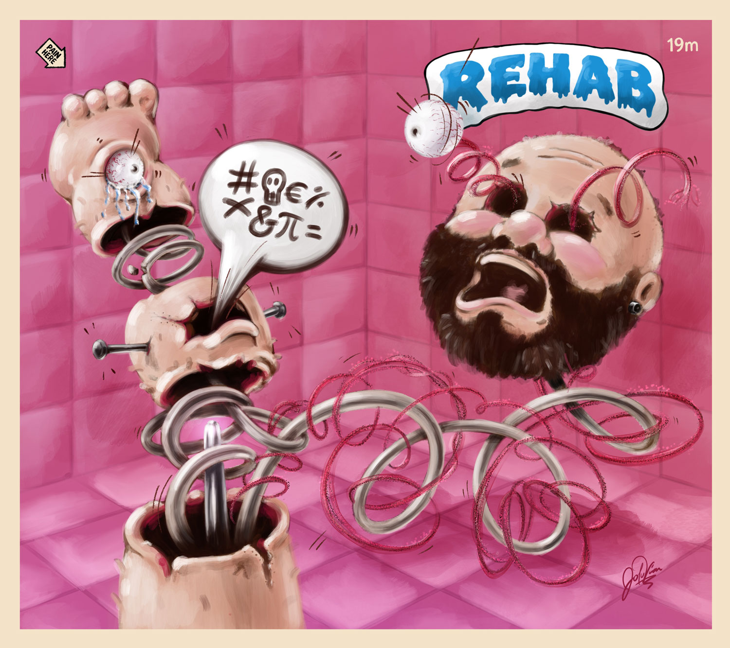 Rehab